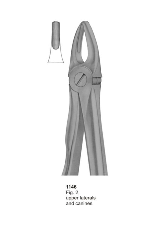 Upper Laterals and Canines