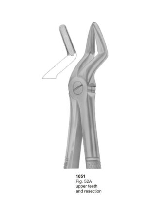 Upper Teeth and Resection
