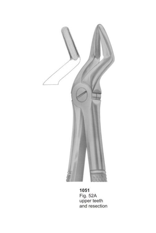 Upper Teeth and Resection